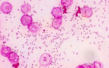 Pasteurella multocida Gram stain