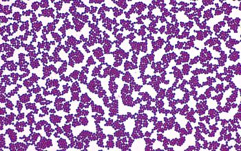 Pediococcus acidilactici Gram stain