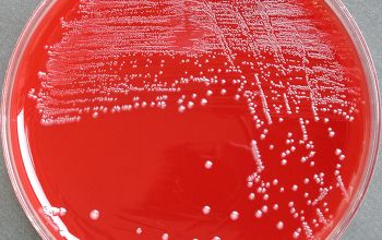 Peptostreptococcus anaerobius Brucella Blood Agar 48h culture anaerobicly incubated