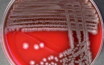 Plesiomonas shigelloides Blood Agar 24h culture incubated with CO2