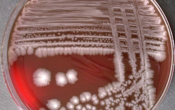 Plesiomonas shigelloides Blood Agar 48h culture incubated with O2