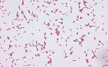 Plesiomonas shigelloides Gram stain