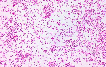 Prevotella corporis Gram stain