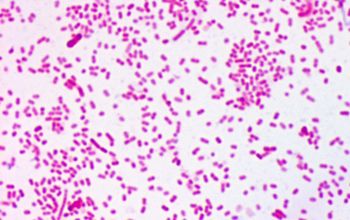 Prevotella corporis Gram stain