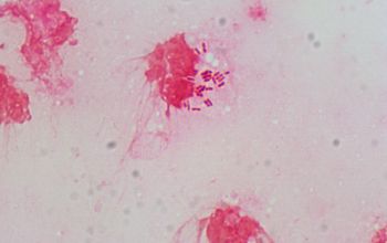 Prevotella dentalis Gram stain