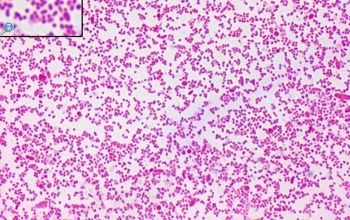 Prevotella oris (Seggatella oris) Gram stain