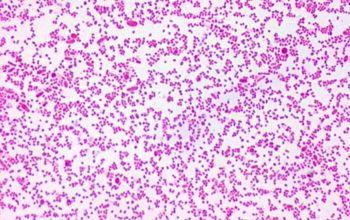 Prevotella oris (Seggatella oris) Gram stain