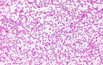 Prevotella oris Gram stain