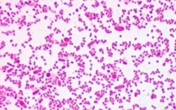 Prevotella oris (Seggatella oris) Gram stain