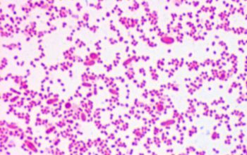 Prevotella oris Gram stain