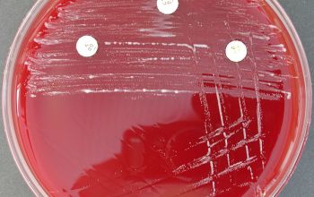 Prevotella oris (Seggatella oris) Brucella Blood Agar 48h culture anaerobicly incubated