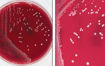 Propionibacterium acnes (Cutibacterium acnes)  culture 