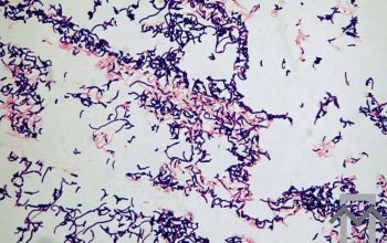 Propionibacterium acnes (Cutibacterium acnes) Gram stain