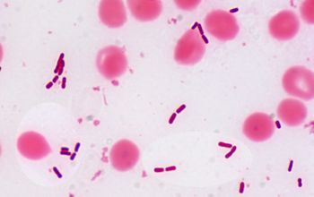 Proteus mirabilis Gram stain