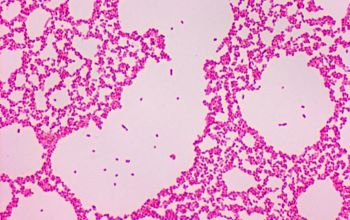 Proteus penneri Gram stain