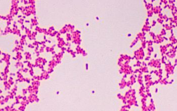 Proteus penneri Gram stain