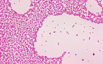 Proteus vulgaris Gram stain