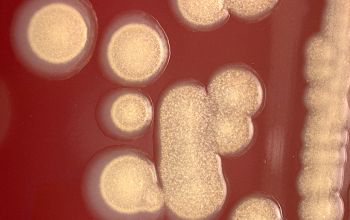 Providencia rettgeri Blood Agar 48h culture 