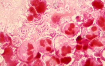 Providencia stuartii Gram stain