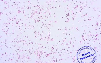 Providencia stuartii Gram stain