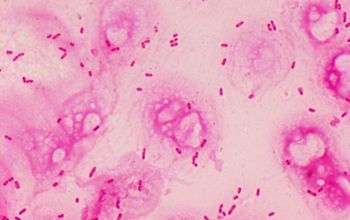 Pseudomonas aeruginosa Gram stain