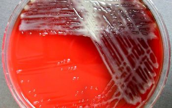 Pseudomonas aeruginosa Blood Agar 24h culture incubated with O2