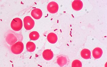 Pseudomonas aeruginosa Gram stain