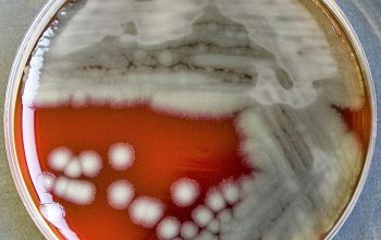 Pseudomonas aeruginosa Blood Agar 24h culture incubated with O2