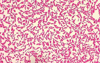 Pseudomonas aeruginosa Gram stain