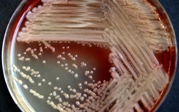 Pseudomonas aeruginosa  culture incubated with O2