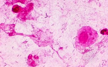 Pseudomonas aeruginosa Gram stain