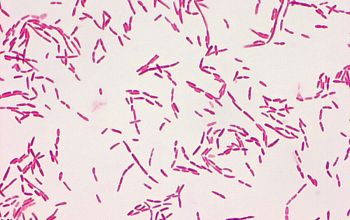 Pseudomonas fluorescens Gram stain