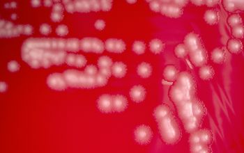 Pseudomonas fluorescens Blood Agar 48h culture incubated with O2