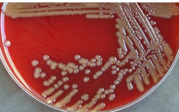 Pseudomonas luteola Blood Agar 48h culture incubated with O2