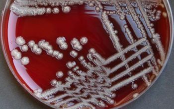 Pseudomonas luteola Blood Agar 48h culture incubated with O2