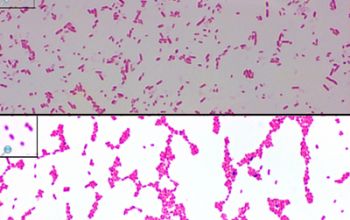 Pseudomonas luteola Gram stain