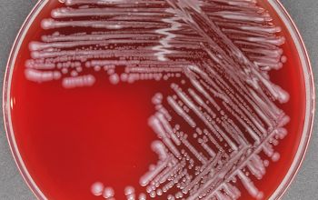 Pseudomonas monteilii Blood Agar 24h culture incubated with O2