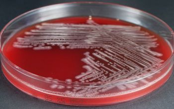 Pseudomonas monteillii Blood Agar 24h culture incubated with O2