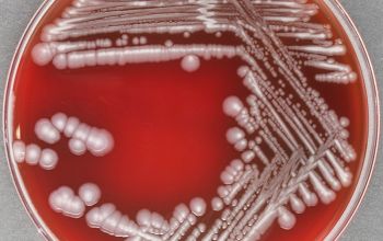 Pseudomonas monteilii Blood Agar 48h culture incubated with O2
