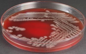 Pseudomonas monteillii Blood Agar 48h culture incubated with O2