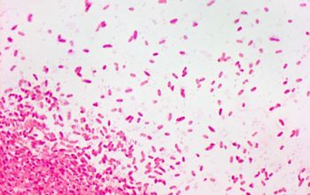 Pseudomonas oryzihabitans Gram stain