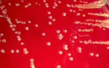 Pseudomonas oryzihabitans  culture incubated with CO2