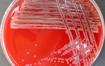 Pseudomonas oryzihabitans Blood Agar 24h culture incubated with CO2