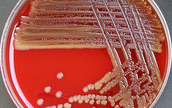 Pseudomonas oryzihabitans Blood Agar 48h culture incubated with O2