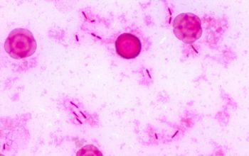 Pseudomonas oryzihabitans Gram stain