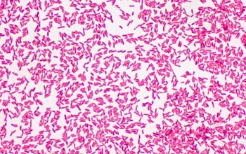 Pseudomonas oryzihabitans Gram stain