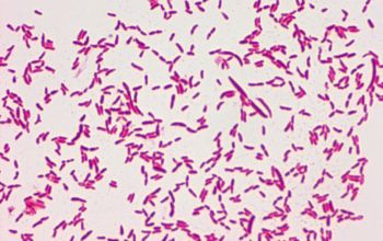 Pseudomonas putida Gram stain