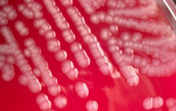 Pseudomonas putida Blood Agar 24h culture incubated with CO2