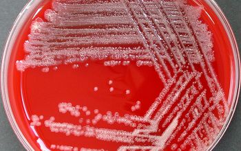 Pseudomonas stutzeri Blood Agar 24h culture incubated with CO2