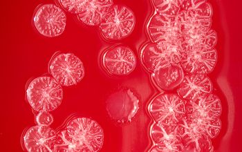 Pseudomonas stutzeri (Stutzerimonas stutzeri) Blood Agar 24h culture incubated with CO2